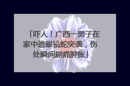吓人！广西一男子在家中遭眼镜蛇突袭，伤处瞬间剧痛肿胀